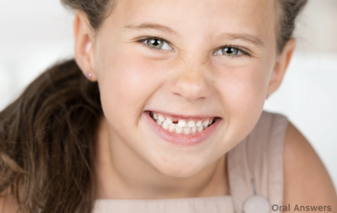 This is Why You Should Save Your Kids’ Baby Teeth - Health 2024 | PopcornTime