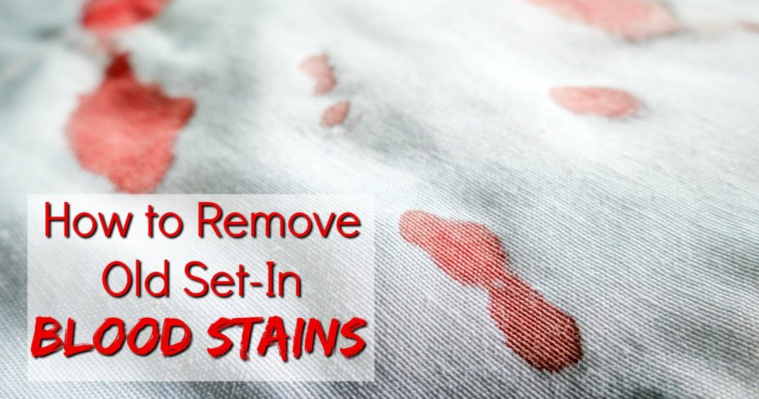 How To Clean Blood Stains From Sofa at Anthony Pitts blog