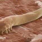 Warning Signs Your Body Is Full Of Parasites And Some Foods That Are Able to Kill Them