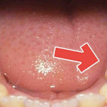 How To Get Rid of Tooth Diseases And Decay Easily At Home