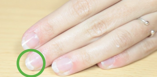 What To Do If Your Nails Are Breaking