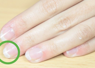What To Do If Your Nails Are Breaking