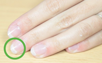 What To Do If Your Nails Are Breaking