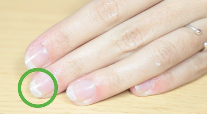 What To Do If Your Nails Are Breaking