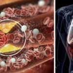 If you have any of these 12 signs, then you probably need more magnesium