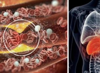 If you have any of these 12 signs, then you probably need more magnesium