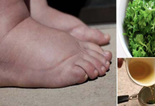 Drink this homemade tea to cure swollen legs