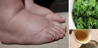 Drink this homemade tea to cure swollen legs