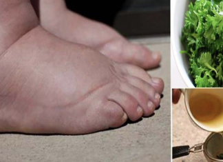Drink this homemade tea to cure swollen legs