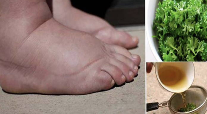 Drink this homemade tea to cure swollen legs