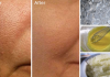 How to easily lessen the appearance of big pores