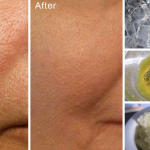 How to easily lessen the appearance of big pores