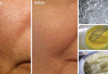 How to easily lessen the appearance of big pores