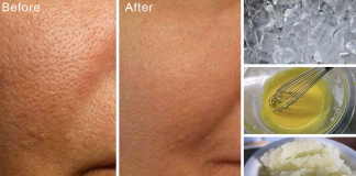 How to easily lessen the appearance of big pores