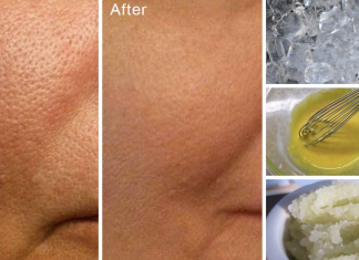 How to easily lessen the appearance of big pores