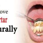 Natural remedies that are going to help you deal with tartar