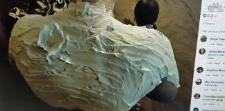 This viral sunburn cure is going to surprise you.