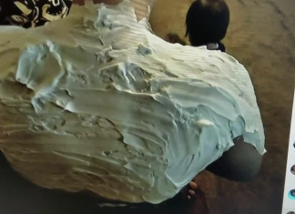 This viral sunburn cure is going to surprise you.