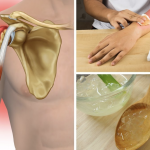 6 home remedies that can help you deal with a sore back