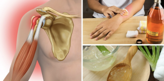 6 home remedies that can help you deal with a sore back