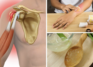 6 home remedies that can help you deal with a sore back