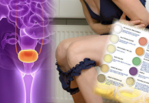 Pay attention to the color of your urine because it reveals many things