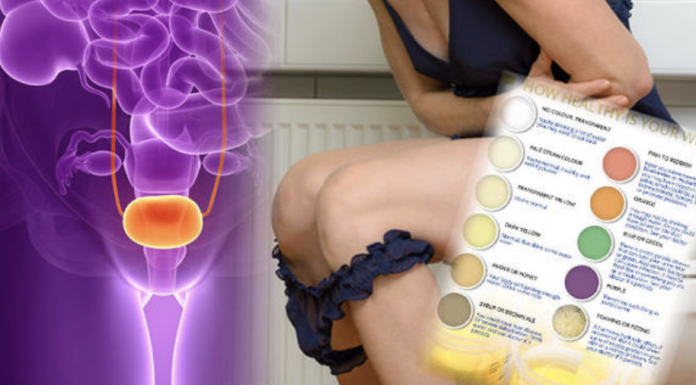 Pay attention to the color of your urine because it reveals many things