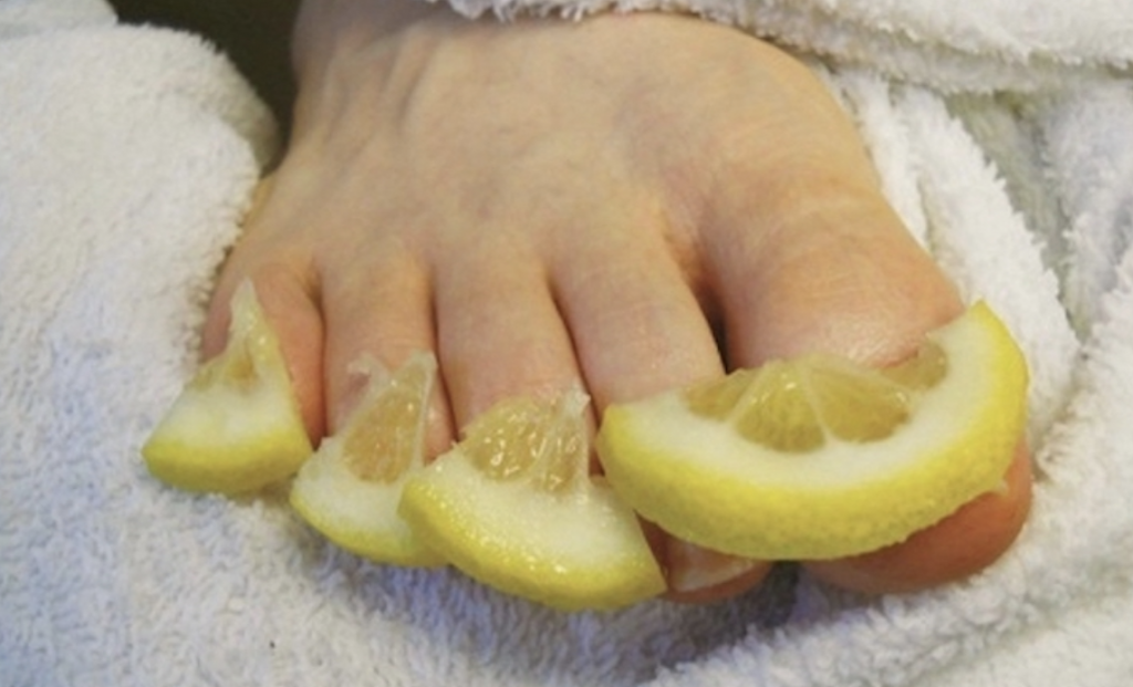 use-these-10-home-remedies-to-deal-with-toenail-fungus-grandma-s-things