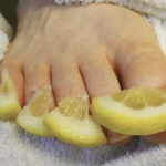 Use these 10 home remedies to deal with toenail fungus