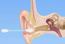 8 Efficient Ways to Clean Your Ears Without Cotton Buds