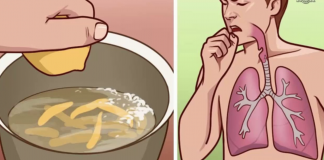 Bronchitis: Grandma’s Home remedies and when to see a doctor