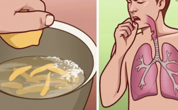 Bronchitis: Grandma’s Home remedies and when to see a doctor