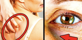 If you have these 5 signs then you are eating too much sugar