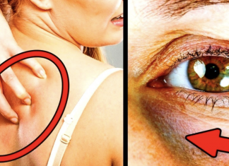 If you have these 5 signs then you are eating too much sugar