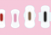 The color of your blood has lots of things to say about your period