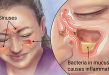 How Clear Out Your Sinuses Using Only Your Fingers In Seconds