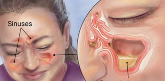 How Clear Out Your Sinuses Using Only Your Fingers In Seconds