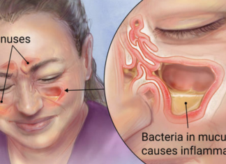 How Clear Out Your Sinuses Using Only Your Fingers In Seconds