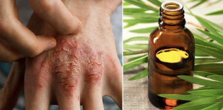 11 tea tree oil uses you never knew before