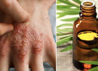 11 tea tree oil uses you never knew before