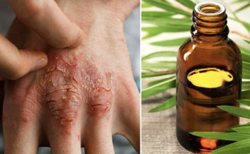11 tea tree oil uses you never knew before