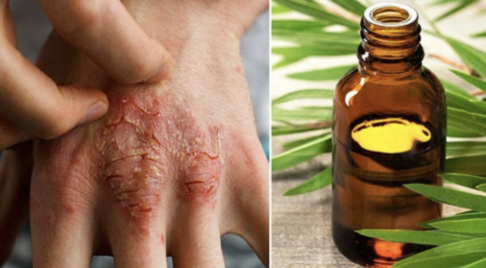 11 tea tree oil uses you never knew before