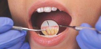 6 Natural Ways To Treat Tooth Infection