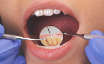 6 Natural Ways To Treat Tooth Infection