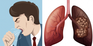 8 Early Lung Cancer Symptoms You Should Not Ignore