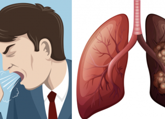 8 Early Lung Cancer Symptoms You Should Not Ignore