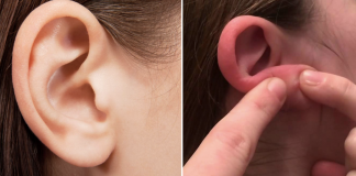 8 natural ways to treat pimples in your ears