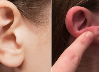 8 natural ways to treat pimples in your ears
