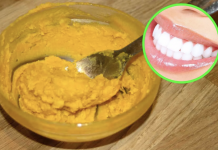 Whiten your teeth and improve your gum’s health using this homemade toothpaste