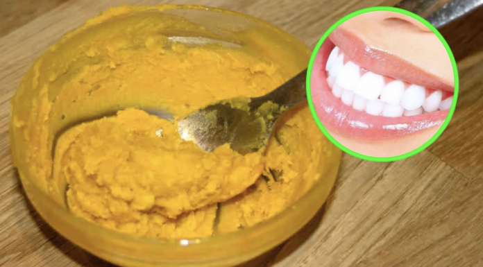 Whiten your teeth and improve your gum’s health using this homemade toothpaste